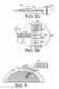 Fig. 04 - Neurotrophic electrode system