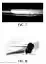 Fig. 05 - Neurotrophic electrode system