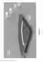Fig. 24 - ELECTRONICS FOR DETECTION OF A CONDITION OF TISSUE