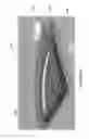 Fig. 25 - ELECTRONICS FOR DETECTION OF A CONDITION OF TISSUE