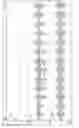 Fig. 16 - Real-time detection of periodic breathing