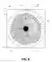 Fig. 08 - Detection of disturbed blood flow