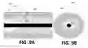 Fig. 11 - Detection of disturbed blood flow
