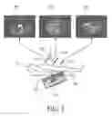 Fig. 03 - Image registration and guidance using concurrent X-plane imaging