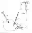 Fig. 01 - Urethral catheterless radical prostatectomy