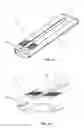 Fig. 08 - System and methods for performing spinal fusion surgery