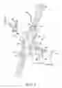 Fig. 09 - Surgical access system and related methods