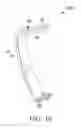 Fig. 11 - Surgical access system and related methods