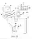 Fig. 13 - Surgical access system and related methods