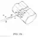 Fig. 17 - Surgical access system and related methods