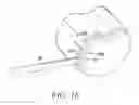 Fig. 19 - Surgical access system and related methods