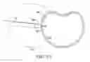 Fig. 20 - Surgical access system and related methods