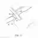Fig. 22 - Surgical access system and related methods