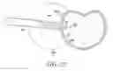 Fig. 24 - Surgical access system and related methods