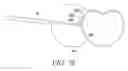 Fig. 27 - Surgical access system and related methods