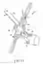 Fig. 32 - Surgical access system and related methods