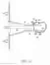 Fig. 34 - Surgical access system and related methods