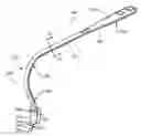 Fig. 01 - RETRACTOR TOOLS FOR MINIMALLY INVASIVE HIP SURGERY