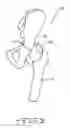 Fig. 03 - RETRACTOR TOOLS FOR MINIMALLY INVASIVE HIP SURGERY
