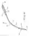 Fig. 11 - RETRACTOR TOOLS FOR MINIMALLY INVASIVE HIP SURGERY