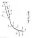 Fig. 13 - RETRACTOR TOOLS FOR MINIMALLY INVASIVE HIP SURGERY