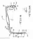Fig. 20 - RETRACTOR TOOLS FOR MINIMALLY INVASIVE HIP SURGERY