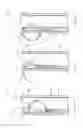 Fig. 04 - Throw and catch suturing device with a curved needle