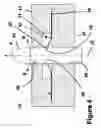 Fig. 05 - Fastener apparatus for tissue and methods of deployment and manufacture