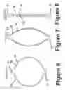 Fig. 07 - Fastener apparatus for tissue and methods of deployment and manufacture