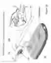 Fig. 14 - Fastener apparatus for tissue and methods of deployment and manufacture