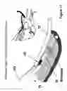 Fig. 16 - Fastener apparatus for tissue and methods of deployment and manufacture
