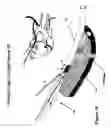 Fig. 17 - Fastener apparatus for tissue and methods of deployment and manufacture