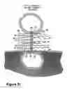 Fig. 20 - Fastener apparatus for tissue and methods of deployment and manufacture