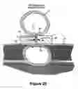 Fig. 22 - Fastener apparatus for tissue and methods of deployment and manufacture