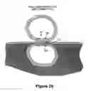 Fig. 24 - Fastener apparatus for tissue and methods of deployment and manufacture
