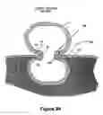 Fig. 27 - Fastener apparatus for tissue and methods of deployment and manufacture