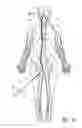 Fig. 03 - Aneurysm treatment coils