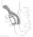 Fig. 01 - Minimally invasive bone sparing acetabular reamer