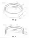 Fig. 10 - Minimally invasive bone sparing acetabular reamer