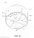 Fig. 11 - Minimally invasive bone sparing acetabular reamer