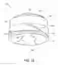 Fig. 13 - Minimally invasive bone sparing acetabular reamer
