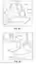Fig. 15 - Patient Selectable Joint Arthroplasty Devices and Surgical Tools