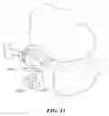 Fig. 22 - Patient Selectable Joint Arthroplasty Devices and Surgical Tools