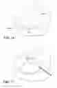 Fig. 24 - Patient Selectable Joint Arthroplasty Devices and Surgical Tools