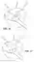 Fig. 30 - Patient Selectable Joint Arthroplasty Devices and Surgical Tools