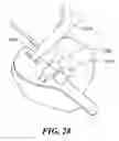Fig. 31 - Patient Selectable Joint Arthroplasty Devices and Surgical Tools