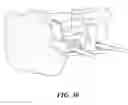 Fig. 33 - Patient Selectable Joint Arthroplasty Devices and Surgical Tools