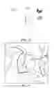 Fig. 34 - Patient Selectable Joint Arthroplasty Devices and Surgical Tools
