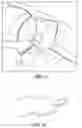 Fig. 35 - Patient Selectable Joint Arthroplasty Devices and Surgical Tools
