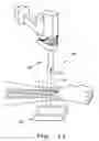 Fig. 11 - SURGICAL VIEWING SYSTEM